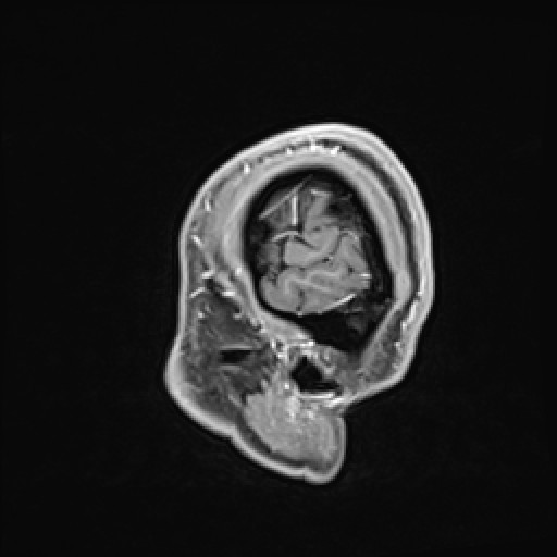 Click on the Serie image to view the images of VILLANUEVA, WILLIAM A.